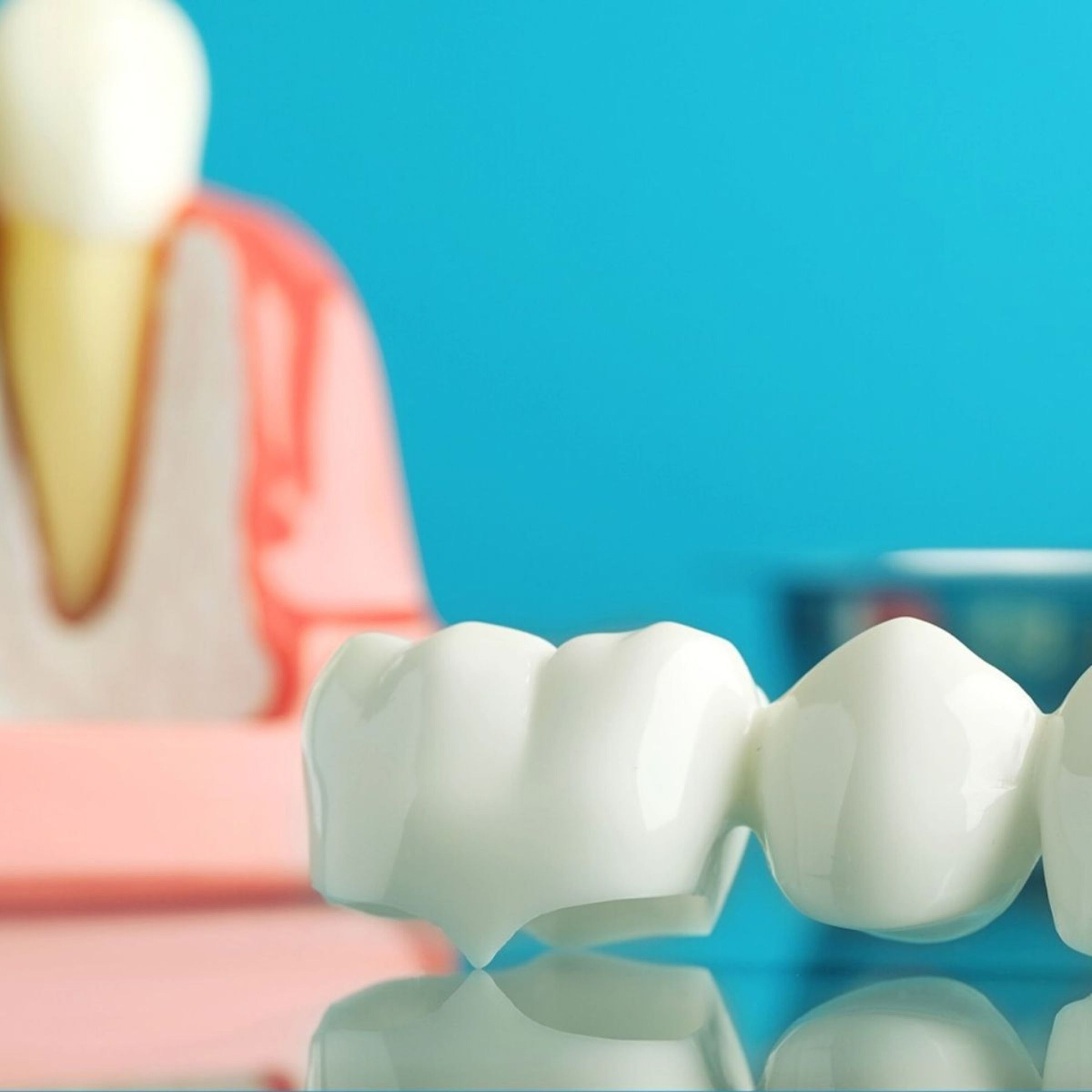 Dental laboratory craftsmanship
